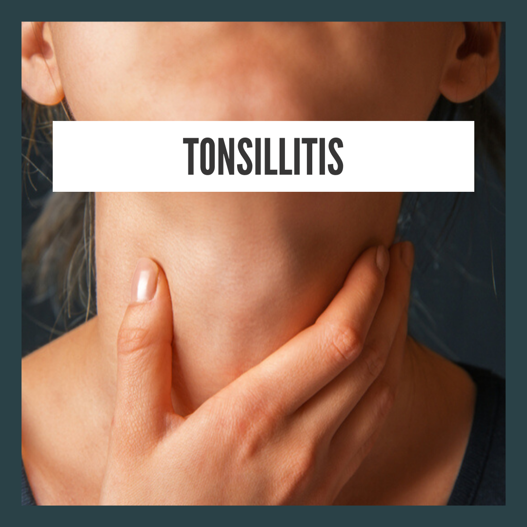 tonsillitis-symptoms-and-natural-treatment-shittyhealth